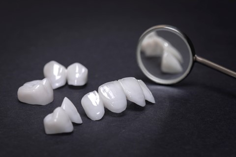 قیمت لمینت دندان 1401