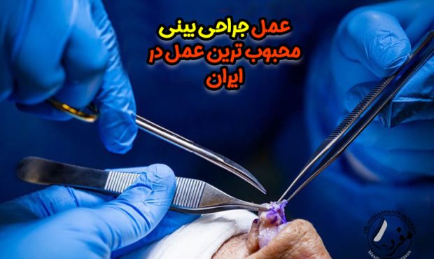 دکتر مفرد : عمل جراحی بینی محبوب ترین عمل در ایران